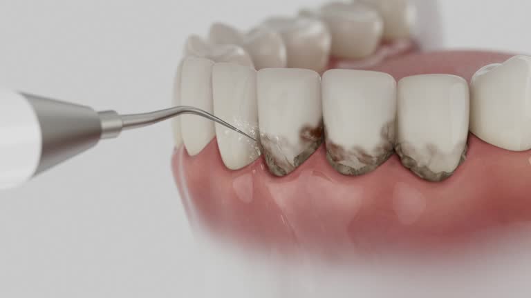 Trusted Tooth Extraction service in San Buenaventura, CA - Dentist Open Now